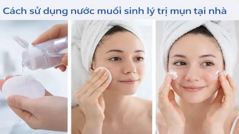 Bật mí cách sử dụng nước muối sinh lý trị mụn đơn giản tại nhà