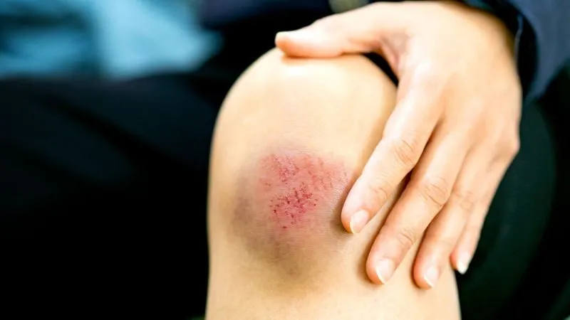 Nhiễm khuẩn bệnh viện có nguy hiểm không?