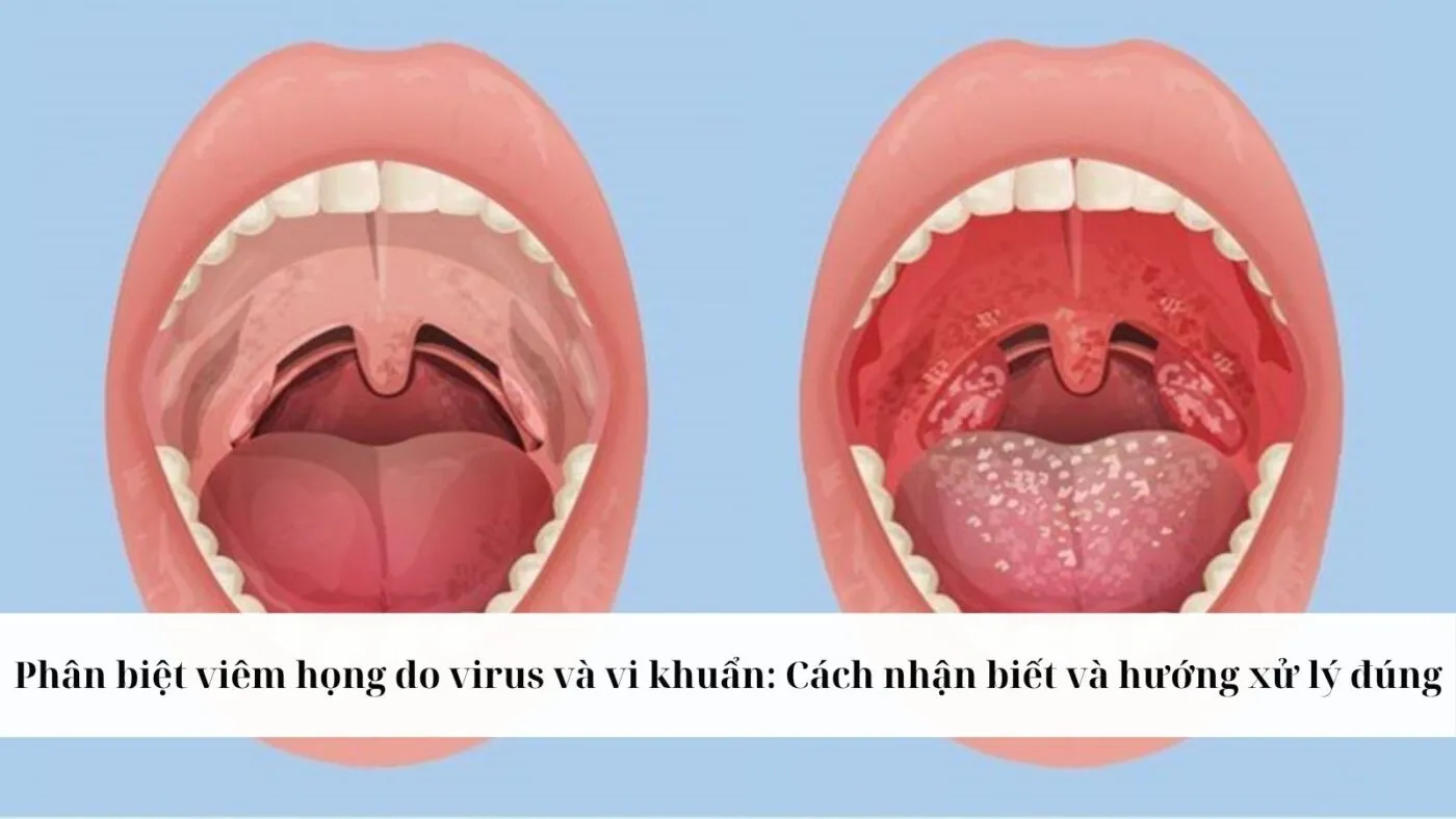 Cách nhận biết và phân biệt virus và vi khuẩn hô hấp